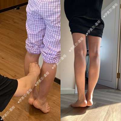 项目图片_瘦腿针