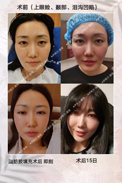 项目图片_眼部手术