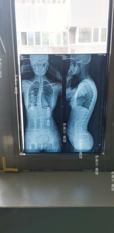 项目图片_zimmer