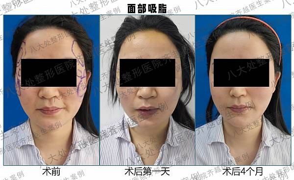 八大处齐越-案例图库_面部雕塑